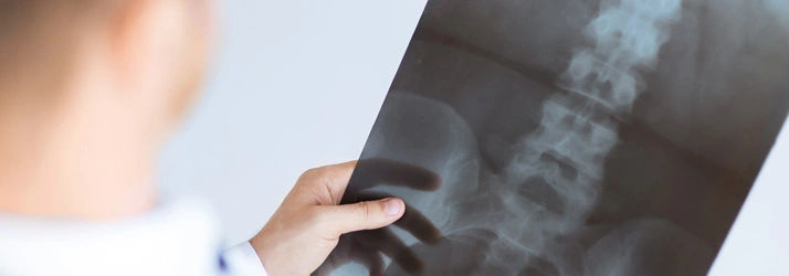 Person holding and examining an X-ray image of a spine